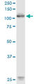 Receptor Tyrosine Kinase Like Orphan Receptor 1 antibody, LS-C139057, Lifespan Biosciences, Western Blot image 