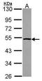 Proteasome 26S Subunit, ATPase 4 antibody, GTX114675, GeneTex, Western Blot image 