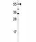 Cytochrome P450 Family 26 Subfamily A Member 1 antibody, F40124-0.4ML, NSJ Bioreagents, Immunohistochemistry frozen image 