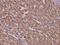MutS Homolog 3 antibody, A02455, Boster Biological Technology, Immunohistochemistry paraffin image 