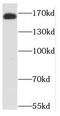 Non-SMC Condensin II Complex Subunit D3 antibody, FNab05577, FineTest, Western Blot image 