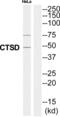 Cathepsin D antibody, abx015199, Abbexa, Western Blot image 