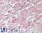 Actin Alpha Cardiac Muscle 1 antibody, LS-B15557, Lifespan Biosciences, Immunohistochemistry paraffin image 