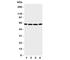 Purinergic Receptor P2X 6 antibody, R31243, NSJ Bioreagents, Western Blot image 