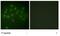 Vitamin D Receptor antibody, GTX52380, GeneTex, Immunofluorescence image 
