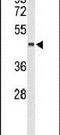 Chitinase Acidic antibody, PA5-26401, Invitrogen Antibodies, Western Blot image 