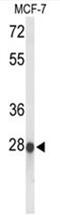 Abhydrolase Domain Containing 11 antibody, AP50028PU-N, Origene, Western Blot image 