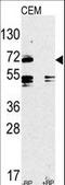 Toll Like Receptor 2 antibody, LS-C98268, Lifespan Biosciences, Western Blot image 