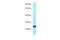 SSU72 Homolog, RNA Polymerase II CTD Phosphatase antibody, A06296, Boster Biological Technology, Western Blot image 