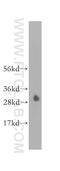 Carbonic Anhydrase 7 antibody, 13670-1-AP, Proteintech Group, Western Blot image 