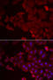 MARCKS Like 1 antibody, STJ29212, St John