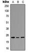 Peroxisomal Biogenesis Factor 11 Gamma antibody, LS-C356242, Lifespan Biosciences, Western Blot image 