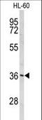 Peroxisomal Biogenesis Factor 14 antibody, LS-C163527, Lifespan Biosciences, Western Blot image 