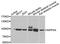 Inositol Polyphosphate-4-Phosphatase Type I A antibody, A7691, ABclonal Technology, Western Blot image 