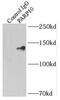 Poly(ADP-Ribose) Polymerase Family Member 10 antibody, FNab06153, FineTest, Immunoprecipitation image 