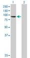 Cytosolic carboxypeptidase-like protein 5 antibody, H00060509-B01P, Novus Biologicals, Western Blot image 