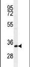 TMEM66 antibody, PA5-24237, Invitrogen Antibodies, Western Blot image 