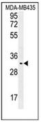 Olfactory Receptor Family 4 Subfamily K Member 2 antibody, AP53060PU-N, Origene, Western Blot image 