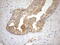 Neuroguidin antibody, M10259, Boster Biological Technology, Immunohistochemistry paraffin image 