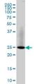 RAB3B, Member RAS Oncogene Family antibody, H00005865-M01, Novus Biologicals, Western Blot image 