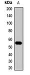 Activin A Receptor Type 1C antibody, orb411623, Biorbyt, Western Blot image 