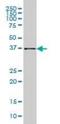 Aldo-Keto Reductase Family 1 Member B10 antibody, orb89792, Biorbyt, Western Blot image 