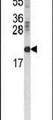 Retinol Binding Protein 2 antibody, PA5-26563, Invitrogen Antibodies, Western Blot image 