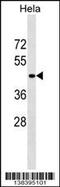 Serpin Family B Member 11 (Gene/Pseudogene) antibody, 59-787, ProSci, Western Blot image 