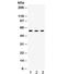 Chaperonin Containing TCP1 Subunit 4 antibody, R32421, NSJ Bioreagents, Western Blot image 