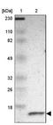 Ring-Box 1 antibody, NBP1-88742, Novus Biologicals, Western Blot image 