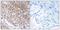 Trafficking Protein Particle Complex 1 antibody, A14697, Boster Biological Technology, Immunohistochemistry paraffin image 