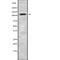 VPS54 Subunit Of GARP Complex antibody, abx219334, Abbexa, Western Blot image 