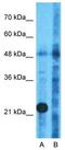 Tryptophanyl TRNA Synthetase 2, Mitochondrial antibody, GTX45787, GeneTex, Western Blot image 