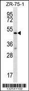 Transducin beta-like protein 2 antibody, 56-679, ProSci, Western Blot image 