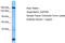 SPT6 Homolog, Histone Chaperone And Transcription Elongation Factor antibody, TA343366, Origene, Western Blot image 