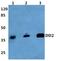 Aldo-Keto Reductase Family 1 Member C2 antibody, PA5-36572, Invitrogen Antibodies, Western Blot image 