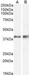 Interleukin 12B antibody, PA5-18741, Invitrogen Antibodies, Western Blot image 