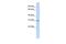 WD Repeat Domain 33 antibody, GTX46692, GeneTex, Western Blot image 