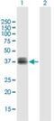 Cellular Communication Network Factor 6 antibody, H00008838-B01P-50ug, Novus Biologicals, Western Blot image 