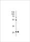 Homeobox protein Hox-C4a antibody, PA5-72627, Invitrogen Antibodies, Western Blot image 