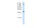 TSC22 Domain Family Member 2 antibody, A13645, Boster Biological Technology, Western Blot image 