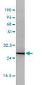 CD58 Molecule antibody, LS-B5386, Lifespan Biosciences, Western Blot image 