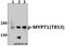 Mbs antibody, A01743T853, Boster Biological Technology, Western Blot image 