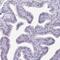 Nucleolar Protein Interacting With The FHA Domain Of MKI67 antibody, NBP2-48642, Novus Biologicals, Immunohistochemistry paraffin image 