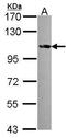 FES Proto-Oncogene, Tyrosine Kinase antibody, GTX107866, GeneTex, Western Blot image 