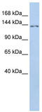 Transmembrane Protein 132B antibody, TA342069, Origene, Western Blot image 