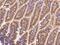 Fatty Acid Binding Protein 6 antibody, 107916-T08, Sino Biological, Immunohistochemistry paraffin image 