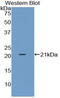 TIMP Metallopeptidase Inhibitor 1 antibody, LS-C302491, Lifespan Biosciences, Western Blot image 