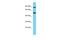 Tetratricopeptide Repeat Domain 25 antibody, A15708, Boster Biological Technology, Western Blot image 