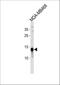 TPD52 Like 3 antibody, A16435-2, Boster Biological Technology, Western Blot image 